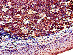 Immunohistochemistry of paraffin-embedded human tonsil tissue using CSB-PA615672LA01HU at dilution of 1:100