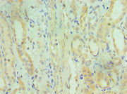 Immunohistochemistry of paraffin-embedded human kidney tissue using CSB-PA615674ESR2HU at dilution of 1:100