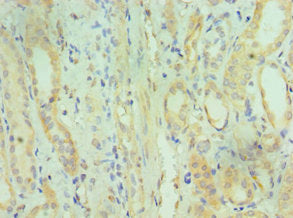 Immunohistochemistry of paraffin-embedded human kidney tissue using CSB-PA615674ESR2HU at dilution of 1:100
