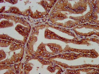 IHC image of CSB-PA615678LA01HU diluted at 1:200 and staining in paraffin-embedded human prostate tissue performed on a Leica BondTM system. After dewaxing and hydration, antigen retrieval was mediated by high pressure in a citrate buffer (pH 6.0)...