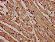 IHC image of CSB-PA615679LA01HU diluted at 1:600 and staining in paraffin-embedded human heart tissue performed on a Leica BondTM system. After dewaxing and hydration, antigen retrieval was mediated by high pressure in a citrate buffer (pH 6.0). S...