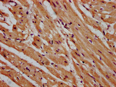 IHC image of CSB-PA615679LA01HU diluted at 1:600 and staining in paraffin-embedded human heart tissue performed on a Leica BondTM system. After dewaxing and hydration, antigen retrieval was mediated by high pressure in a citrate buffer (pH 6.0). S...