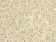 Immunohistochemistry of paraffin-embedded human liver tissue using CSB-PA615684ESR2HU at dilution of 1:100