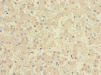 Immunohistochemistry of paraffin-embedded human liver tissue using CSB-PA615684ESR2HU at dilution of 1:100