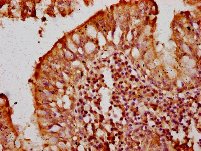 IHC image of CSB-PA615690LA01HU diluted at 1:300 and staining in paraffin-embedded human lung tissue performed on a Leica BondTM system. After dewaxing and hydration, antigen retrieval was mediated by high pressure in a citrate buffer (pH 6.0). Se...