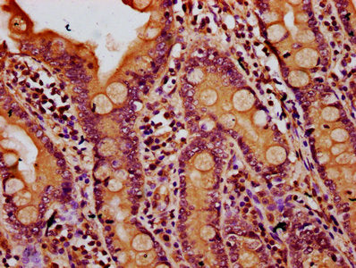 IHC image of CSB-PA615701LA01HU diluted at 1:500 and staining in paraffin-embedded human small intestine tissue performed on a Leica BondTM system. After dewaxing and hydration, antigen retrieval was mediated by high pressure in a citrate buffer (...