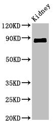 Western Blot Positive WB detected in: Mouse kidney tissue All lanes: CDH18 antibody at 2.4ug/ml Secondary Goat polyclonal to rabbit IgG at 1/50000 dilution Predicted band size: 89, 64 kDa Observed band size: 89 kDa
