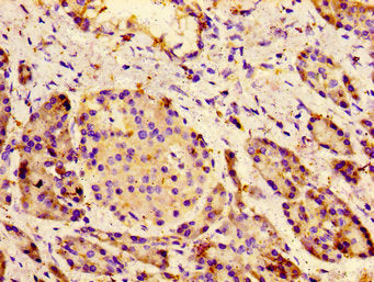 Immunohistochemistry of paraffin-embedded human pancreatic tissue using CSB-PA615724LA01HU at dilution of 1:100