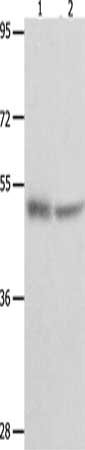 Gel: 10%SDS-PAGE, Lysate: 60 ug, Lane 1-2: Human fetal muscle tissue, 231 cells, Primary antibody: CSB-PA615731(TP73 Antibody) at dilution 1/300, Secondary antibody: Goat anti rabbit IgG at 1/8000 dilution, Exposure time: 10 minutes