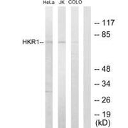 Western blot analysis of extracts from HeLa cells, Jurkat cells and COLO205 cells, using HKR1 antibody.