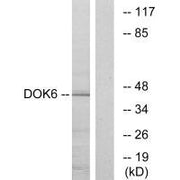 Western blot analysis of extracts from COLO cells, using DOK6 antibody.