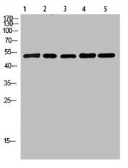 Western Blot analysis of 1,mouse-lung 2,mouse-brain 3,mouse-spleen 4,mouse-kidney 5,mouse-heart cells using primary antibody diluted at 1:500(4°C overnight). Secondary antibody:Goat Anti-rabbit IgG IRDye 800( diluted at 1:5000, 25°C, 1 hour)