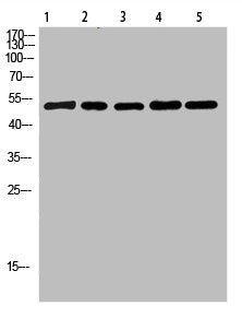Western Blot analysis of 1,mouse-lung 2,mouse-brain 3,mouse-spleen 4,mouse-kidney 5,mouse-heart cells using primary antibody diluted at 1:500(4°C overnight). Secondary antibody:Goat Anti-rabbit IgG IRDye 800( diluted at 1:5000, 25°C, 1 hour)