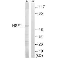 Western blot analysis of extracts from Jurkat cells, using HSF1 (Ab-121) antibody.