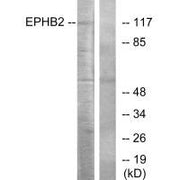 Western blot analysis of extracts from Jurkat cells, using EPHB2 antibody.