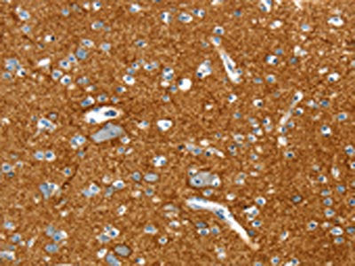 The image on the left is immunohistochemistry of paraffin-embedded Human brain tissue using CSB-PA616353(PTPN3 Antibody) at dilution 1/20, on the right is treated with fusion protein. (Original magnification: ×200)