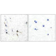 Immunohistochemical analysis of paraffin-embedded human brain tissue using Potassium Channel Kv3.2b antibody.