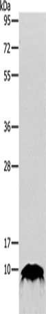 Gel: 10+12%SDS-PAGE, Lysate: 40 ug, Lane: Human fetal kidney tissue, Primary antibody: CSB-PA617703(TFF1 Antibody) at dilution 1/100, Secondary antibody: Goat anti rabbit IgG at 1/8000 dilution, Exposure time: 30 seconds