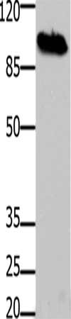 Gel: 8%SDS-PAGE, Lysate: 30 ug, Lane: Mouse brain tissue, Primary antibody: CSB-PA617795(DNM1 Antibody) at dilution 1/100, Secondary antibody: Goat anti rabbit IgG at 1/8000 dilution, Exposure time: 2 minutes