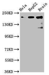 Western Blot Positive WB detected in: Hela whole cell lysate, HepG2 whole cell lysate, Rat brain tissue All lanes: CKAP5 antibody at 6µg/ml Secondary Goat polyclonal to rabbit IgG at 1/50000 dilution Predicted band size: 226, 219, 227 kDa Observed...