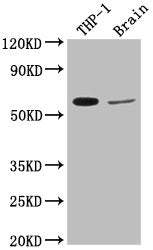 Western Blot Positive WB detected in: THP-1 whole cell lysate, Rat brain tissue All lanes: COL9A2 antibody at 1:2000 Secondary Goat polyclonal to rabbit IgG at 1/50000 dilution Predicted band size: 66 kDa Observed band size: 66 kDa