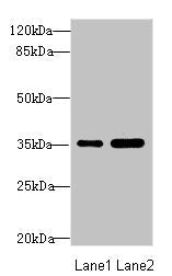 Western blot All lanes: TOB2 antibody at 1.89ug/ml Lane 1: Mouse skeletal muscle tissue Lane 2: Mouse heart tissue Secondary Goat polyclonal to rabbit IgG at 1/10000 dilution Predicted band size: 37, 28 kDa Observed band size: 37 kDa