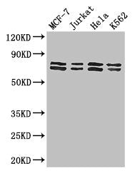 Western Blot Positive WB detected in: MCF-7 whole cell lysate, Jurkat whole cell lysate, Hela whole cell lysate, K562 whole cell lysate All lanes: TRIM25 antibody at 3ug/ml Secondary Goat polyclonal to rabbit IgG at 1/50000 dilution Predicted band...