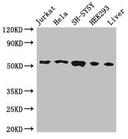 Western Blot Positive WB detected in: Jurkat whole cell lysate, Hela whole cell lysate, SH-SY5Y whole cell lysate, HEK293 whole cell lysate, Mouse liver tissue All lanes: FKBP8 antibody at 3ug/ml Secondary Goat polyclonal to rabbit IgG at 1/50000...