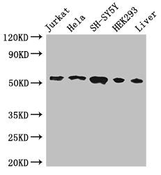 Western Blot Positive WB detected in: Jurkat whole cell lysate, Hela whole cell lysate, SH-SY5Y whole cell lysate, HEK293 whole cell lysate, Mouse liver tissue All lanes: FKBP8 antibody at 3ug/ml Secondary Goat polyclonal to rabbit IgG at 1/50000...