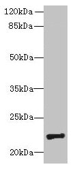 Western blot All lanes: PIGH antibody at 4µg/ml + Mouse kidney tissue Secondary Goat polyclonal to rabbit IgG at 1/10000 dilution Predicted band size: 22 kDa Observed band size: 22 kDa
