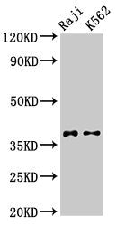 Western Blot Positive WB detected in: Raji whole cell lysate, K562 whole cell lysate All lanes: DMC1 antibody at 3.2µg/ml Secondary Goat polyclonal to rabbit IgG at 1/50000 dilution Predicted band size: 38, 32 kDa Observed band size: 38 kDa