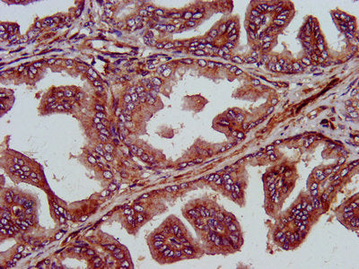 IHC image of CSB-PA617926LA01HU diluted at 1:400 and staining in paraffin-embedded human prostate tissue performed on a Leica BondTM system. After dewaxing and hydration, antigen retrieval was mediated by high pressure in a citrate buffer (pH 6.0)...