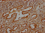 IHC image of CSB-PA617930LA01HU diluted at 1:100 and staining in paraffin-embedded human lung tissue performed on a Leica BondTM system. After dewaxing and hydration, antigen retrieval was mediated by high pressure in a citrate buffer (pH 6.0). Se...