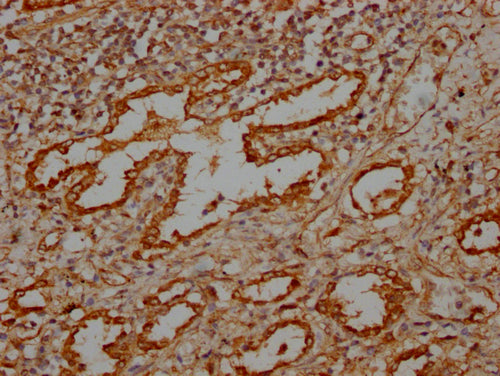 IHC image of CSB-PA617930LA01HU diluted at 1:100 and staining in paraffin-embedded human lung tissue performed on a Leica BondTM system. After dewaxing and hydration, antigen retrieval was mediated by high pressure in a citrate buffer (pH 6.0). Se...