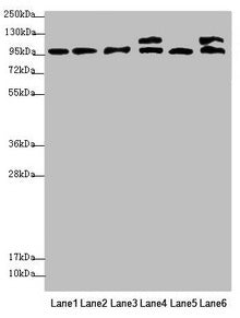 Western blot All lanes: NAA25 antibody at 2.12µg/ml Lane 1: Mouse liver tissue Lane 2: Mouse kidney tissue Lane 3: Hela whole cell lysate Lane 4: 293T whole cell lysate Lane 5: A549 whole cell lysate Lane 6: HepG2 whole cell lysate Secondary Goat...