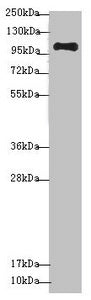 Western blot All lanes: NAA25 antibody at 1.36 ug/ml + Mouse kidney tissue Secondary Goat polyclonal to rabbit IgG at 1/10000 dilution Predicted band size: 113, 100 kDa Observed band size: 113 kDa
