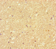 Immunohistochemistry of paraffin-embedded human brain tissue using CSB-PA617994LA01HU at dilution of 1:100
