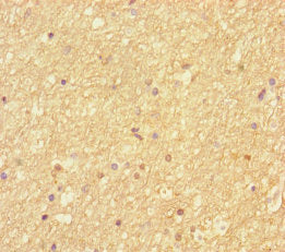 Immunohistochemistry of paraffin-embedded human brain tissue using CSB-PA617994LA01HU at dilution of 1:100