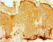 Immunohistochemistry of paraffin-embedded human skin tissue using CSB-PA617995ESR1HU at dilution of 1:100