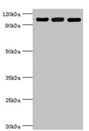 Western blot All lanes: 116 kDa U5 small nuclear ribonucleoprotein component antibody at 3ug/ml Lane 1: Hela whole cell lysate Lane 2: 293T whole cell lysate Lane 3: NIH/3T3 whole cell lysate Secondary Goat polyclonal to rabbit IgG at 1/10000 dilu...