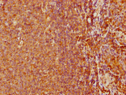 IHC image of CSB-PA617999LA01HU diluted at 1:500 and staining in paraffin-embedded human tonsil tissue performed on a Leica BondTM system. After dewaxing and hydration, antigen retrieval was mediated by high pressure in a citrate buffer (pH 6.0)....
