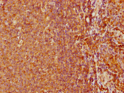IHC image of CSB-PA617999LA01HU diluted at 1:500 and staining in paraffin-embedded human tonsil tissue performed on a Leica BondTM system. After dewaxing and hydration, antigen retrieval was mediated by high pressure in a citrate buffer (pH 6.0)....