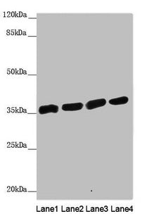 Western blot All lanes: ANKRD1 antibody at 1.91µg/ml Lane 1: Hela whole cell lysate Lane 2: 293T whole cell lysate Lane 3: Jurkat whole cell lysate Lane 4: HepG2 whole cell lysate Secondary Goat polyclonal to rabbit IgG at 1/10000 dilution Predict...