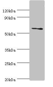 Western blot All lanes: DHCR24 antibody at 2ug/ml + Jurkat whole cell lysate Secondary Goat polyclonal to rabbit IgG at 1/10000 dilution Predicted band size: 61, 55 kDa Observed band size: 61 kDa