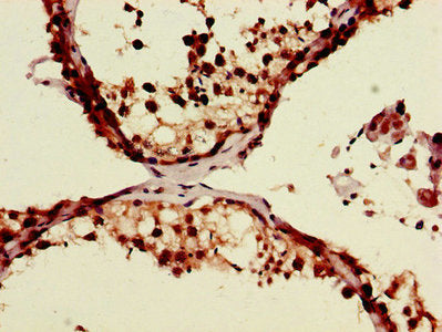 Immunohistochemistry of paraffin-embedded human testis tissue using CSB-PA618014LA01HU at dilution of 1:100