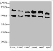 Western blot All lanes: ELF2 antibody at 3.35ug/ml Lane 1: HL60 whole cell lysate Lane 2: A549 whole cell lysate Lane 3: MCF-7 whole cell lysate Lane 4: Jurkat whole cell lysate Lane 5: Hela whole cell lysate Lane 6: Mouse lung tissue Secondary Go...