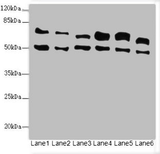 Western blot All lanes: ELF2 antibody at 3.35ug/ml Lane 1: HL60 whole cell lysate Lane 2: A549 whole cell lysate Lane 3: MCF-7 whole cell lysate Lane 4: Jurkat whole cell lysate Lane 5: Hela whole cell lysate Lane 6: Mouse lung tissue Secondary Go...