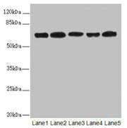 Western blot All lanes: ELF2 antibody at 2.27ug/ml Lane 1: HL60 whole cell lysate Lane 2: A549 whole cell lysate Lane 3: MCF-7 whole cell lysate Lane 4: Jurkat whole cell lysate Lane 5: Hela whole cell lysate Secondary Goat polyclonal to rabbit Ig...