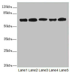 Western blot All lanes: ELF2 antibody at 2.27ug/ml Lane 1: HL60 whole cell lysate Lane 2: A549 whole cell lysate Lane 3: MCF-7 whole cell lysate Lane 4: Jurkat whole cell lysate Lane 5: Hela whole cell lysate Secondary Goat polyclonal to rabbit Ig...