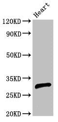 Western Blot Positive WB detected in: Rat heart tissue All lanes: CEBPE antibody at 2.7ug/ml Secondary Goat polyclonal to rabbit IgG at 1/50000 dilution Predicted band size: 31 kDa Observed band size: 31 kDa
